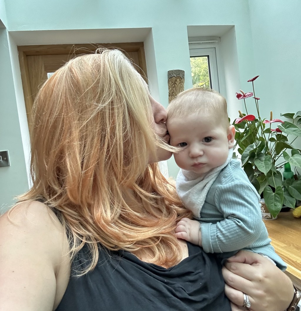 Why Is My Hair Falling Out After Birth? The Science of Postpartum Hair&nbsp;Loss